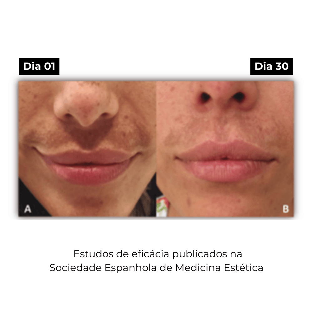 Elixir ATX, Sérum Facial Anti-Origem das Manchas