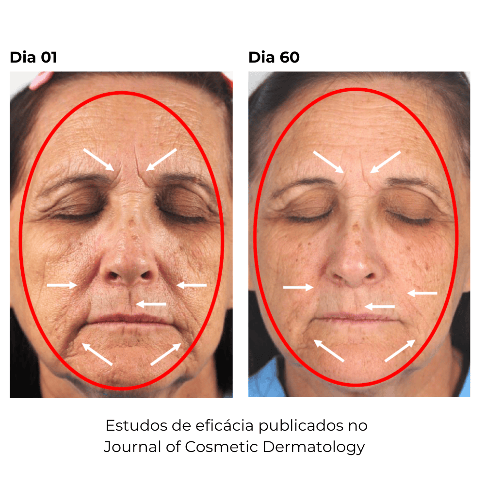 PhytoHormon, Sérum Facial Rejuvenescedor para Pele na Menopausa