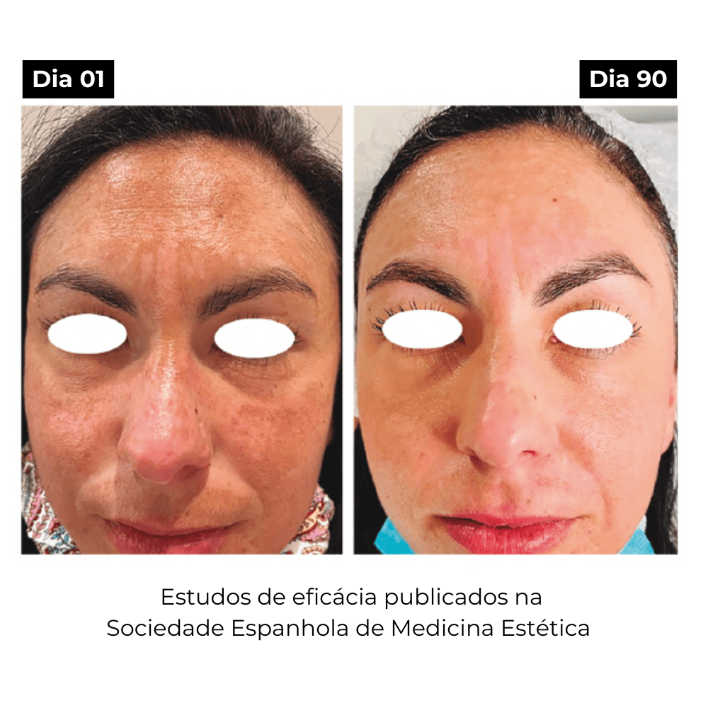 Elixir ATX, Sérum Facial Anti-Origem das Manchas