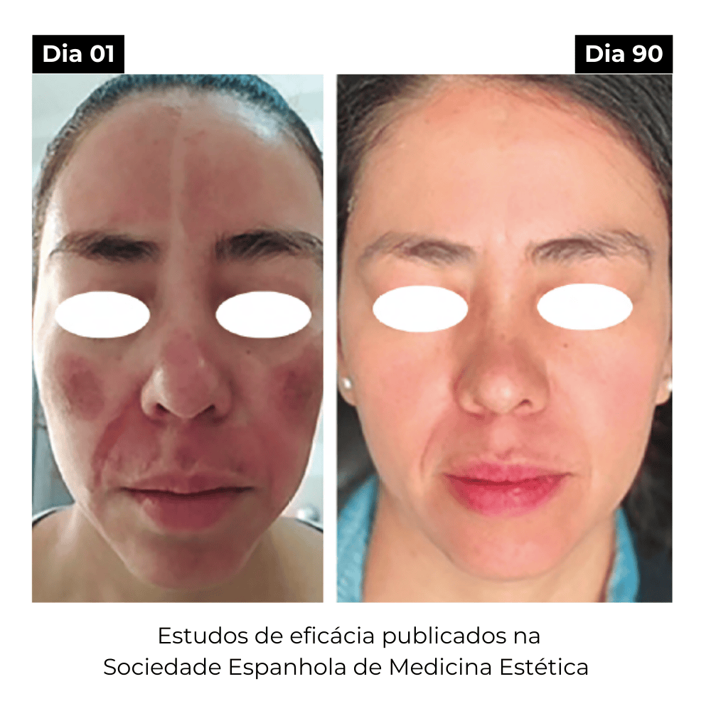 Elixir ATX, Sérum Facial Anti-Origem das Manchas