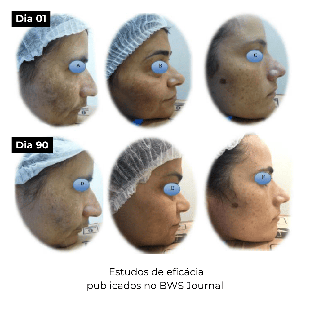 Elixir ATX, Sérum Facial Anti-Origem das Manchas