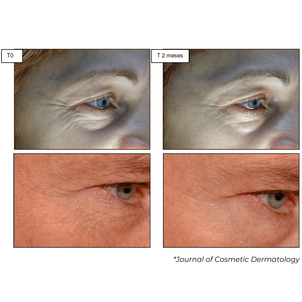 Multi Active Eye, Sérum Rejuvenescedor para Área dos Olhos com Argirelox