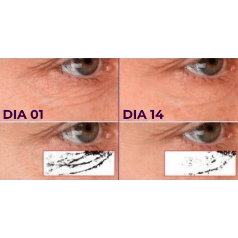 Elixir A, Sérum Facial para Pele Madura com Retinol HPR e Phytoesqualano