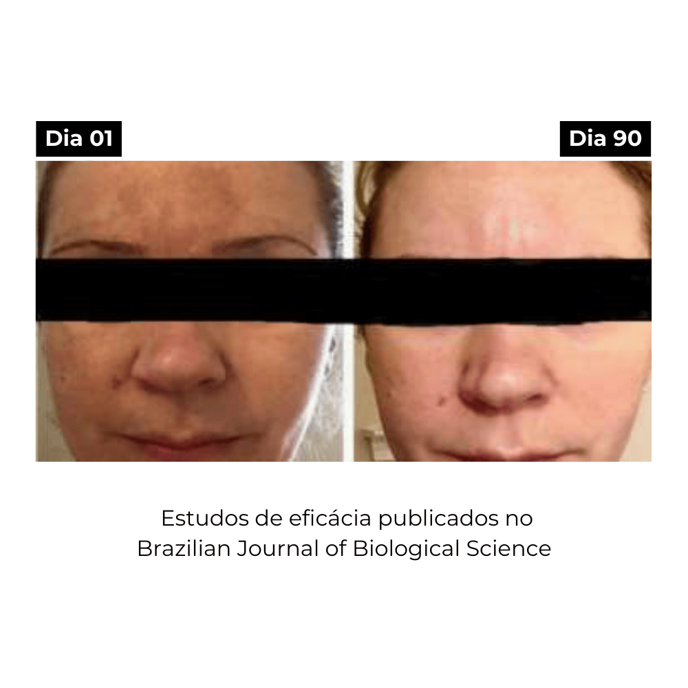 Elixir ATX, Sérum Facial Anti-Origem das Manchas