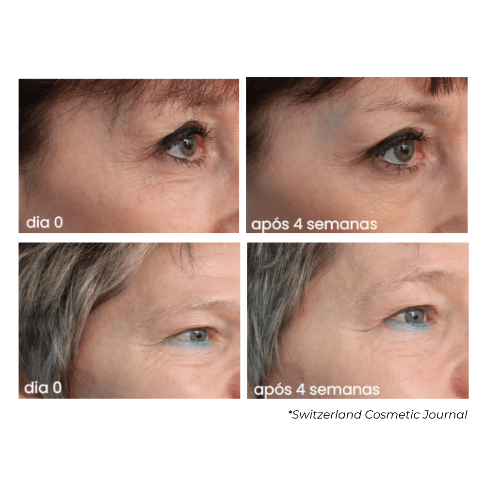 Multi Active Eye, Sérum Rejuvenescedor para Área dos Olhos com Argirelox